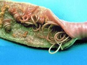 Cauzele paraziților din corpul uman