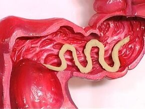 paraziți în corpul uman de ce apar