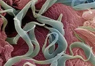 Simptomele și tratamentul paraziților în corpul uman