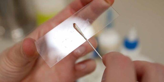 Răzuirea pielii pentru paraziți