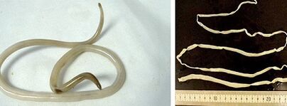 tipuri de paraziți din corpul uman