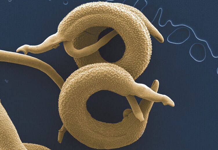 paraziți care trăiesc în corpul uman