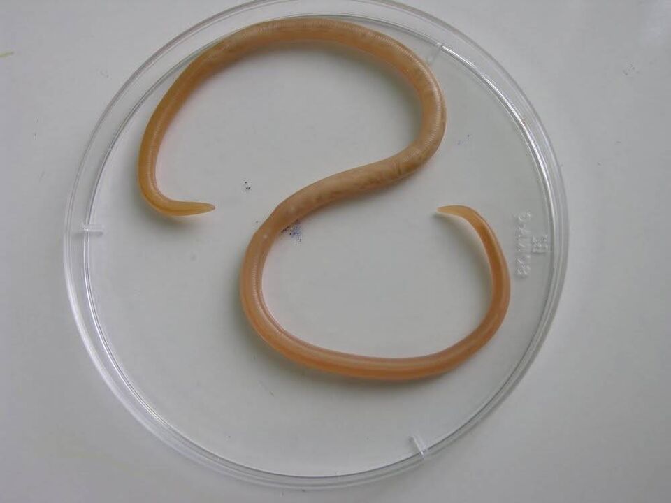 cum arată paraziții la copii